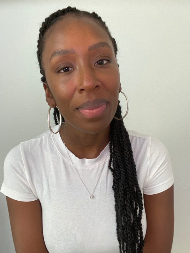 BIANCA before using revive day and night lip balm. Lips appear dry and dehydrated.