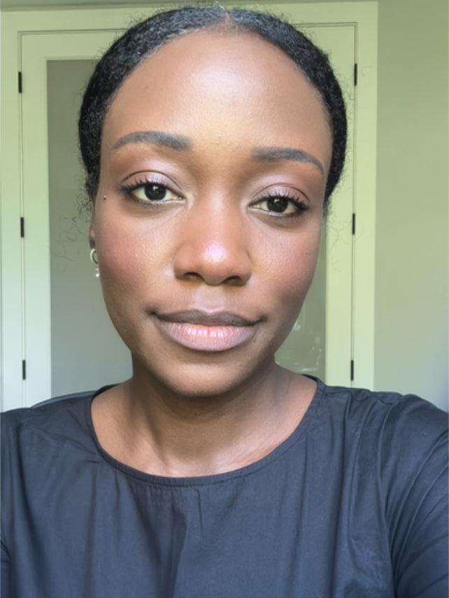 BRITTANY's lips before applying the revive day and night lip balm. Lips appear dry and unnourished